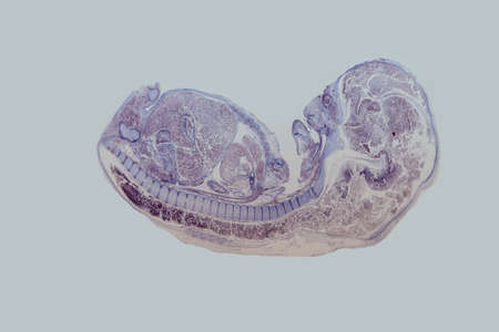 Longitudinal section of an mouse ebryo