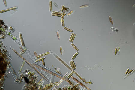 various diatoms from a river