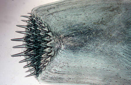 Fish scale with spinous spin under the microscope 100x