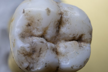 human molars with tooth roots in close up