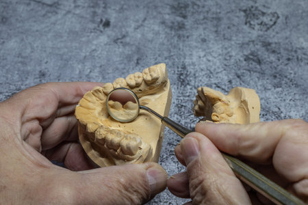 Dental technician looks at a model of the teeth and processes it close-upの写真素材