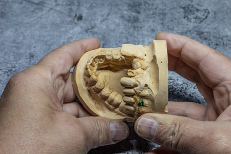 Dental technician looks at a model of the teeth and processes it close-up