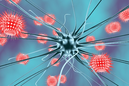 Viral encephalitis, neuroinfection, brain infection, neuron and viruses, brain cell infected by viruses, scientific background, medical background, healthcare backgroundの写真素材