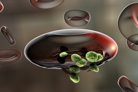 Malaria. Release of malaria parasites from red blood cell. Merozoites of Plasmodium falciparum, Plasmodium vivax, Plasmodium malariae or Plasmodium ovaleの写真素材