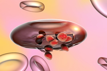 Malaria. Release of malaria parasites from red blood cell. Merozoites of Plasmodium falciparum, Plasmodium vivax, Plasmodium malariae or Plasmodium ovaleの写真素材