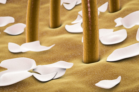 Dandruff on the surface of skin with hairs, 3D illustrationの写真素材