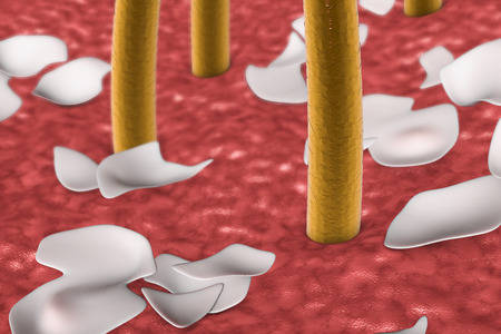 Dandruff on the surface of skin with hairs, 3D illustrationの写真素材