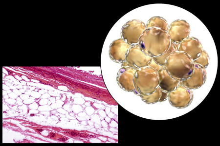 White adipose tissue, light micrograph and 3D illustration, hematoxilin and eosin staining, magnification 100x. Fat cells (adipocytes) have large lipid droplet which remains unstainedの写真素材