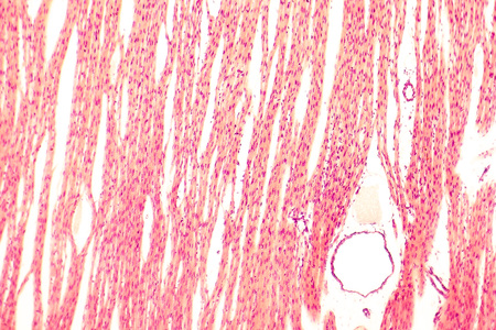 Heart muscle, light micrograph. Striated cardiac muscle cells myocytes. Light microscopy, hematoxilin and eosin stain, magnification 100xの写真素材