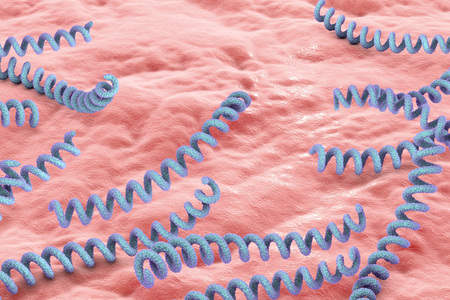 Treponema pallidum on the surface of human skin or mucus membrane, bacterium which causes syphilis,...