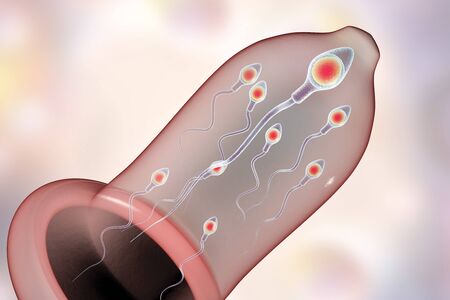 Contraception concept 3D illustration. Condom with spermatozoans