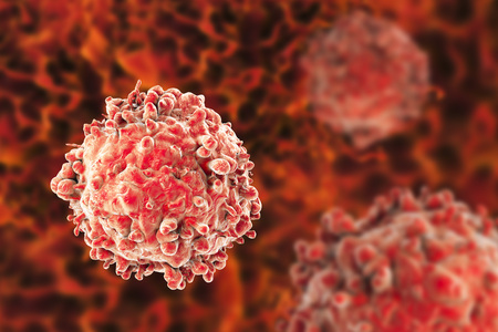 Leukaemia white blood cells, 3D illustration. Cancer cellsの写真素材