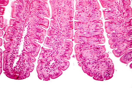 Villi of small intestine, light micrograph, magnification 100x
