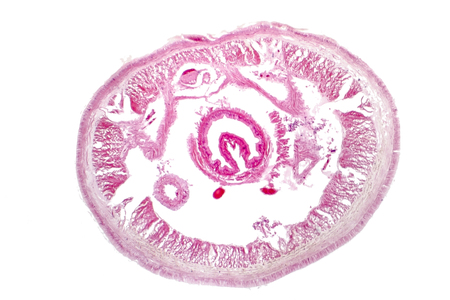 Earth worm, light micrograph of a cross-section. Light microscopy