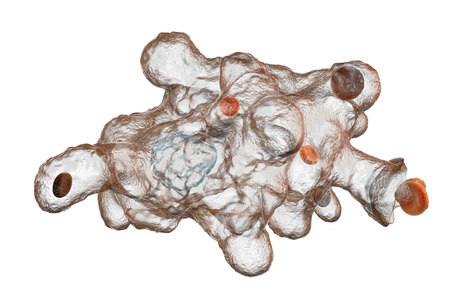 Entamoeba histolytica protozoan engulfing red blood cells. Parasite which causes amoebic dysentery...