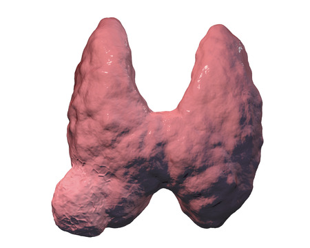 Thyroid cancer. 3D illustration showing thyroid gland with tumor isolated on white background