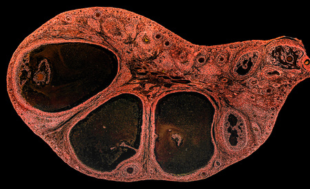Light micrograph of ovary showing primordial, primary and secondary follicles. Light microscopy, hematoxylin and eosin stain, magnification 200x. Colors are enhanced for better visualisationの写真素材