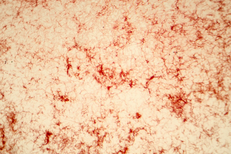 Actinomycetes, gram-positive anaerobic bacteria which resemble fungi, light micrograph. Actinomyces live in human gums and cause infections in dental procedures, oral abscesses and actinomycosisの写真素材