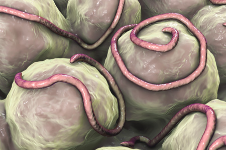 Helminths nematodes Enterobius in the gut. Threadworm which cause enterobiasis, 3D illustration