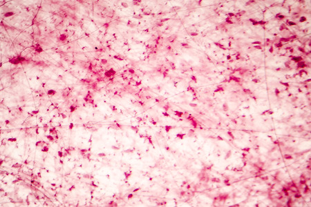 Human loose connective tissue, light photomicrograph, hematoxylin and eosin stainingの写真素材