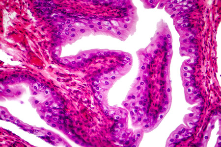 Transitional epithelium tissue of the urinary bladder under microscope, light micrograph,...