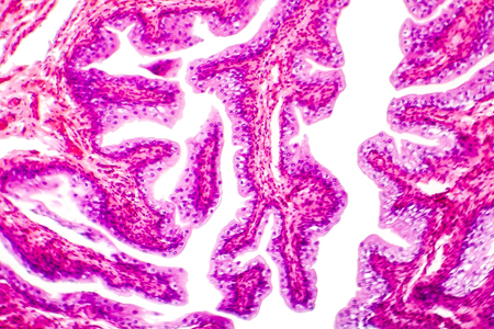 Transitional epithelium tissue of the urinary bladder under microscope, light micrograph,...