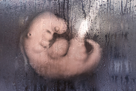 Social awareness concept against abortion. 3D illustration showing 4-week human embryo behind window glass with rain condensation illustrating post-abortion depressionの写真素材