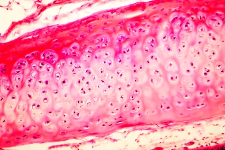 Hyaline cartilage of human trachea, light micrographの写真素材