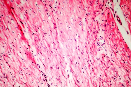 Human smooth muscle, cross section, light micrographの写真素材