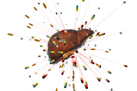 Conceptual image of drug-induced hepatotoxicity, 3D illustrationの写真素材