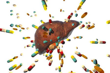 Conceptual image of drug-induced hepatotoxicity, 3D illustrationの写真素材