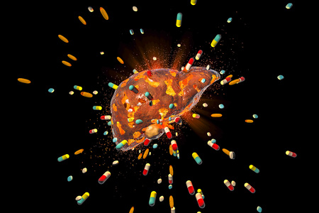 Conceptual image of drug-induced hepatotoxicity, 3D illustration