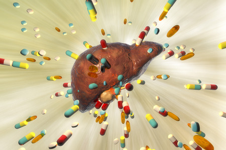 Conceptual image of drug-induced hepatotoxicity, 3D illustrationの写真素材