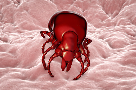 Tick Ixodes, an arthropod responsible for transmission of bacterium Borrelia burgdorferi that causes Lyme disease, it also transmits viral encephalitis and other infections, 3D illustrationの写真素材
