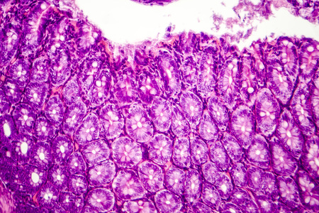 Histology of human appendix, micrograph showing Crypts of Lieberkuhn. Photo under microscopeの写真素材