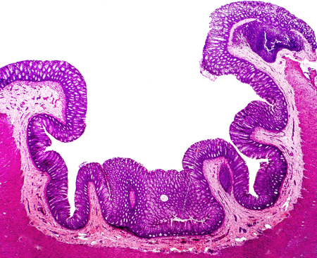 Histology of human appendix, cross-section, micrograph showing epithelium and Crypts of Lieberkuhn. Photo under microscope, isolated on white backgroundの写真素材