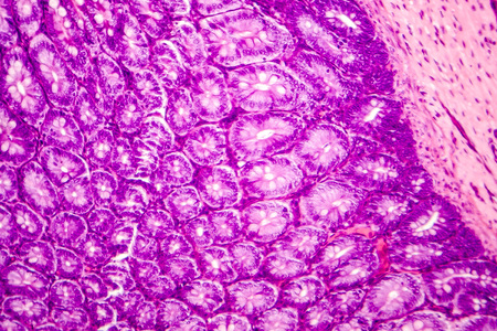 Histology of human appendix, micrograph showing Crypts of Lieberkuhn. Photo under microscopeの写真素材