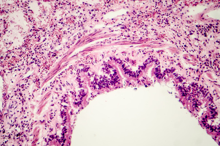Cross-section of human lung tissue showing fragment of bronchiole, histology, micrograph, photo under microscopeの写真素材