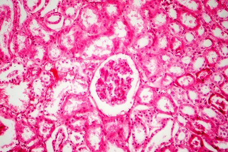 Histology of human kidney, light micrograph showing nephrons. Microscopy, hematoxylin and eosin stainingの写真素材