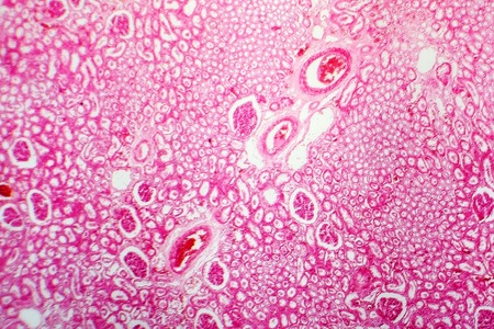 Histology of human kidney, light micrograph showing nephrons. Microscopy, hematoxylin and eosin staining