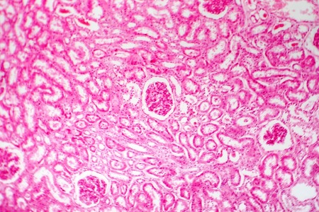Histology of human kidney, light micrograph showing nephrons. Microscopy, hematoxylin and eosin stainingの写真素材