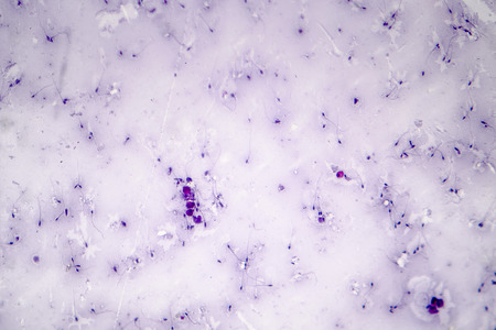Sperm morphology. Semen photo under microscope. Micrograph showing spermatozoonsの写真素材