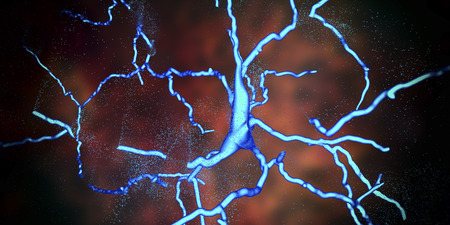 Degeneration of dopaminergic neuron, a key stage of development of Parkinsons disease, 3D illustrationの写真素材