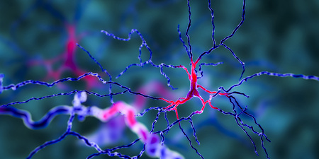 Dopaminergic neuron, computer reconstruction. Degeneration of this brain cells are responsible for...