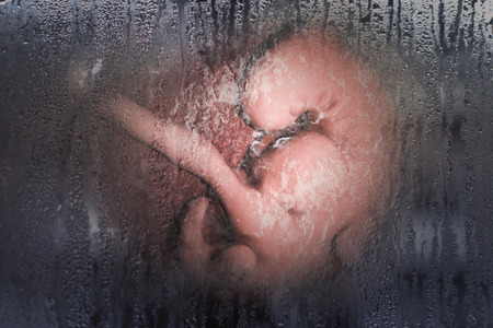 Social awareness concept against abortion. 3D illustration showing 4-week human embryo behind window glass with rain condensation illustrating post-abortion depressionの写真素材