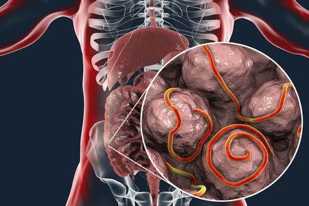 Helminths nematodes Enterobius in the gut. Threadworm which causes enterobiasis, 3D illustration...