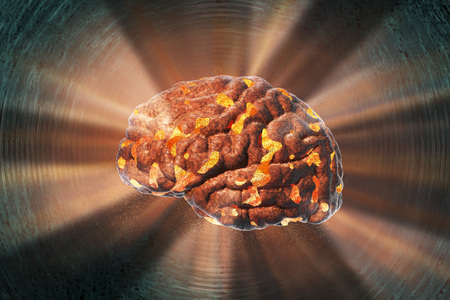 Brain destruction, medical concept for brain disease, burnout, depression, headache or migraine, 3D...