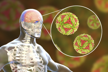 Japanese encephalitis, medical concept, 3D illustration showing brain infection and close-up view of...