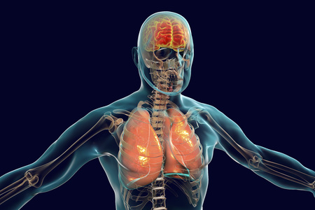 Human body with highlighted brain and lungs, concept for encephalitis and pneumonia infections and complications, 3D illustrationの写真素材