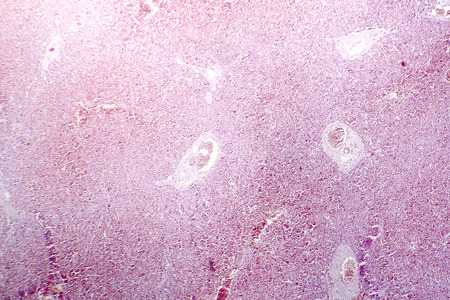 Acute hepatic congestion, light micrograph, an acute consequence of right heart failureの写真素材